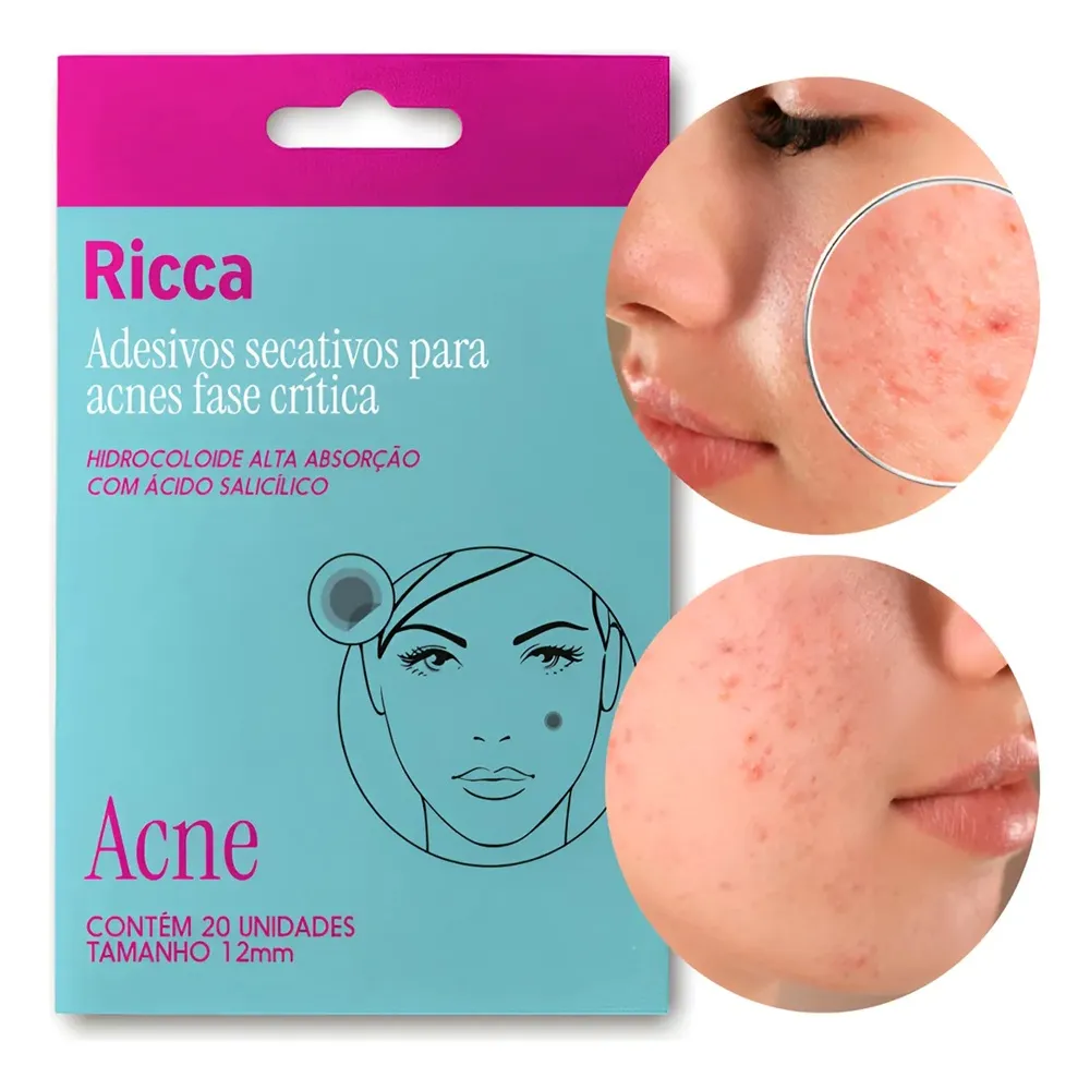 Adesivos Secativos Para Acnes Ricca Fase Crítica