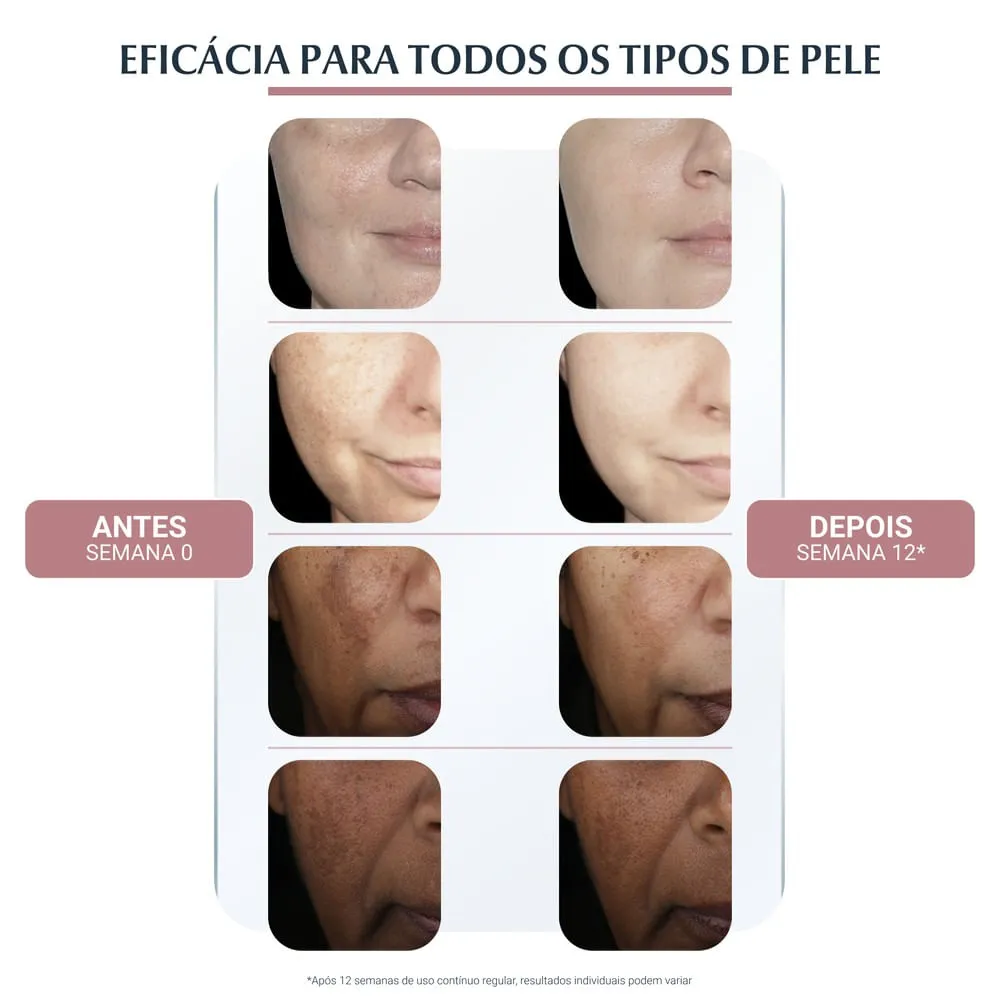 Creme Facial Eucerin Anti-Pigment Noite 50ml — foto 5