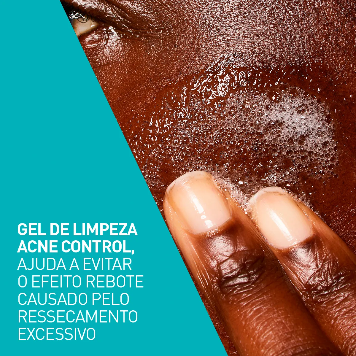Gel de Limpeza Facial CeraVe Acne Control 340g — foto 5