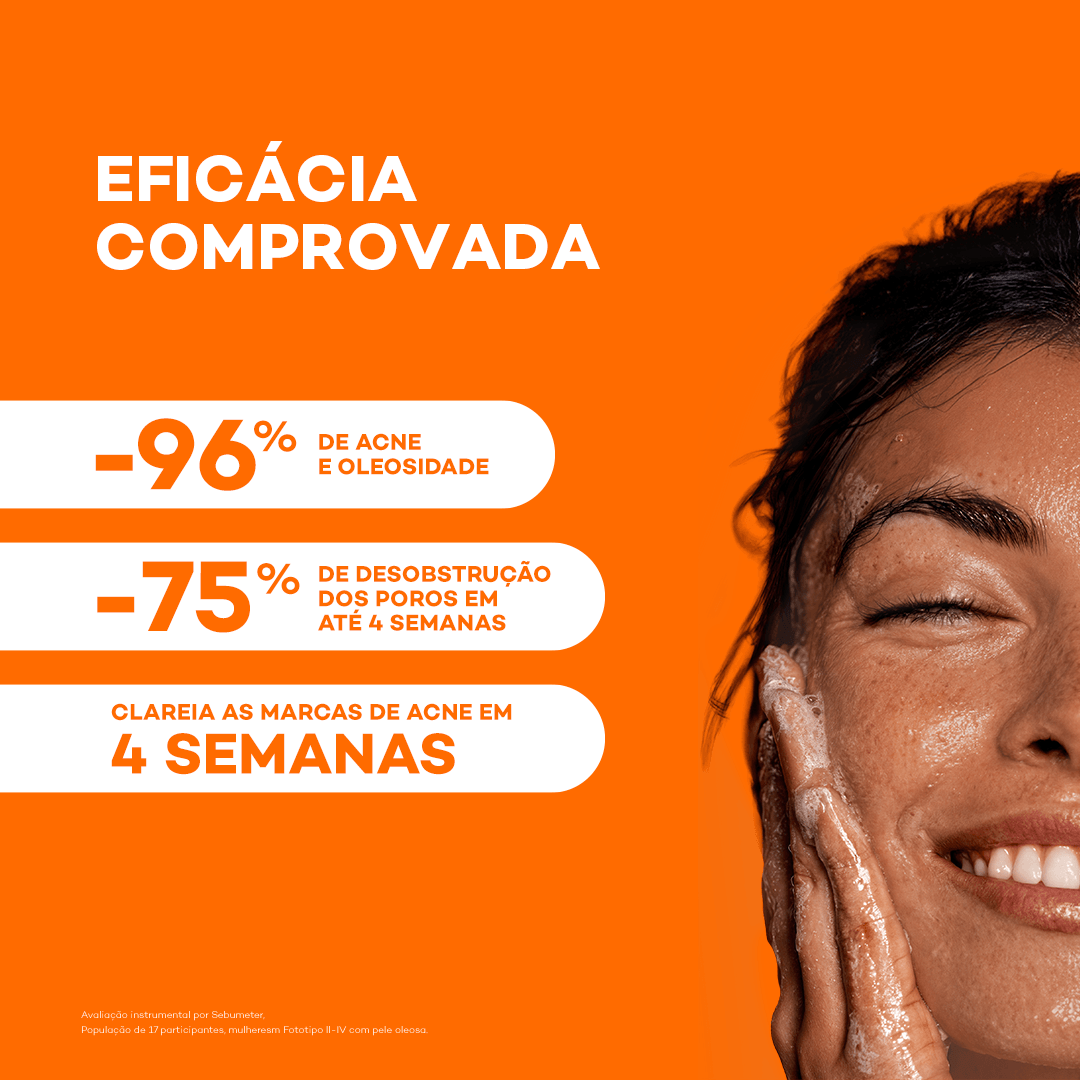 Sabonete em Barra Facial Darrow Actine Pele Acneica 70g — foto 4