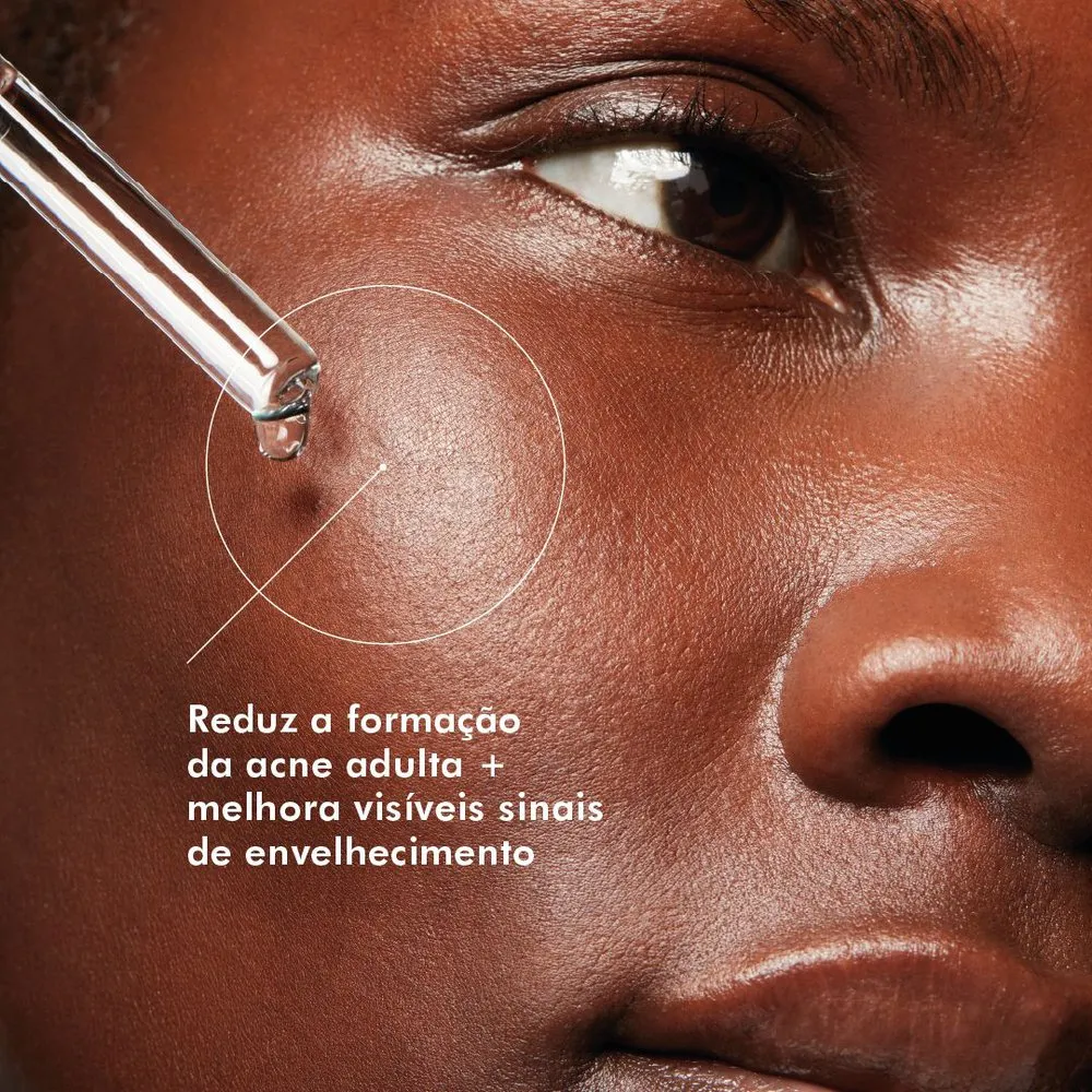 Sérum SkinCeuticals Blemish + Age Defense Tripla Ação 30ml — foto 9