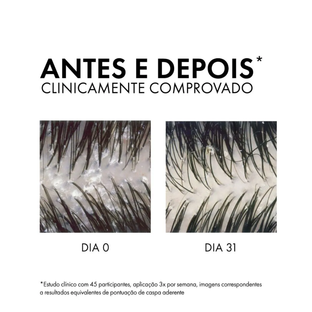 Shampoo Anticaspa Vichy Dercos Technique Ds 300g 23% De Desconto — foto 4