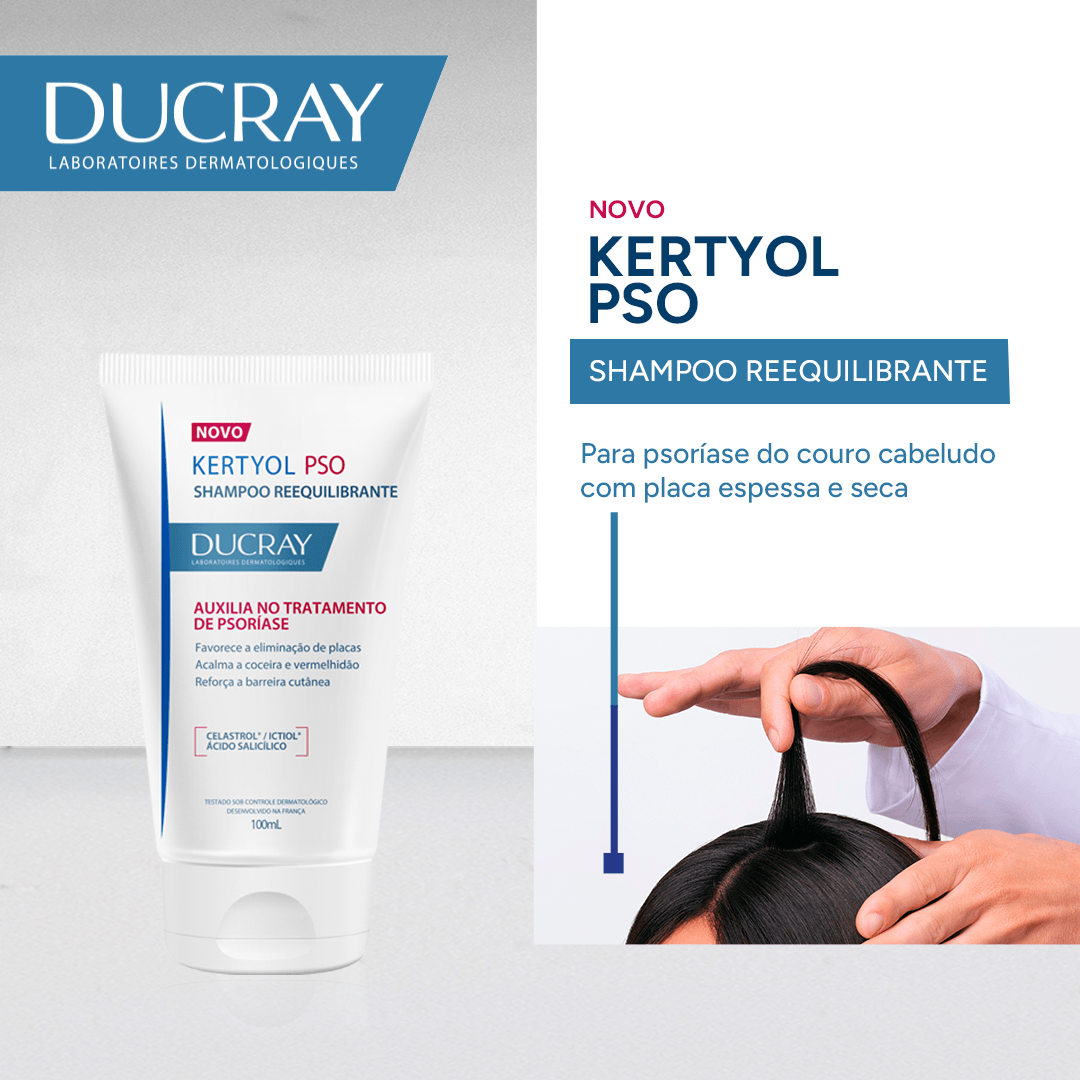 Shampoo Ducray Kertyol P.S.O Tratamento para Psoríase 100ml — foto 2