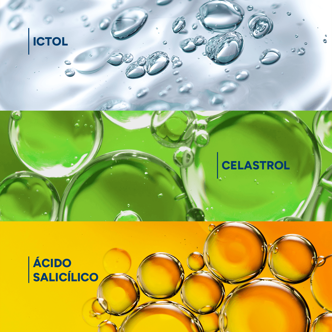Shampoo Ducray Kertyol P.S.O Tratamento para Psoríase 100ml — foto 4