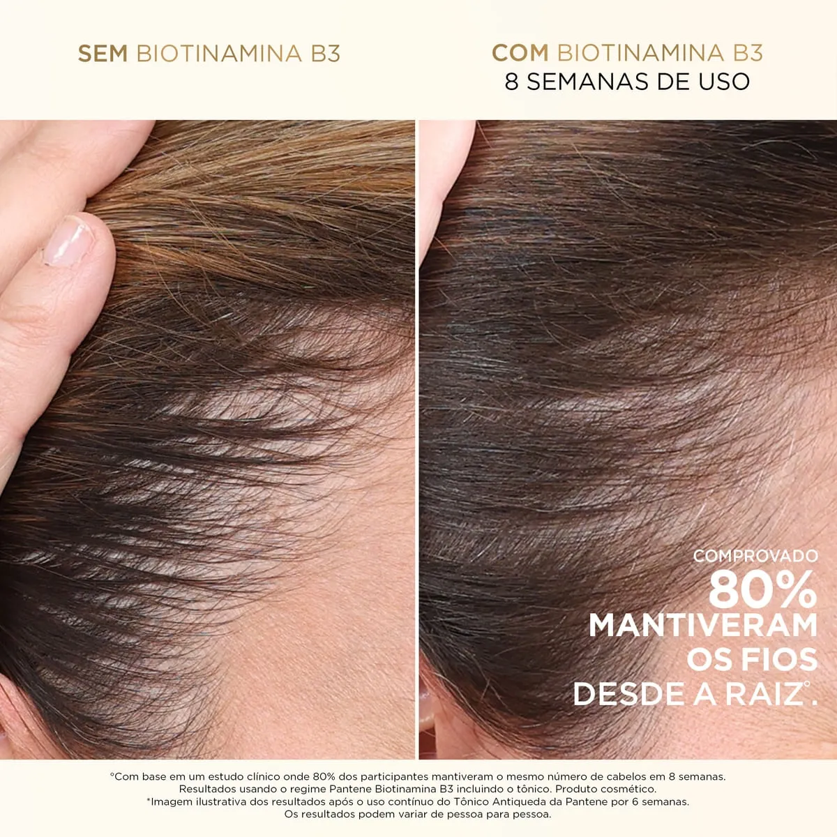 Shampoo Pantene Pro-V Miracles Biotinamina B3 Antiquebra & Nutrição 510ml — foto 5